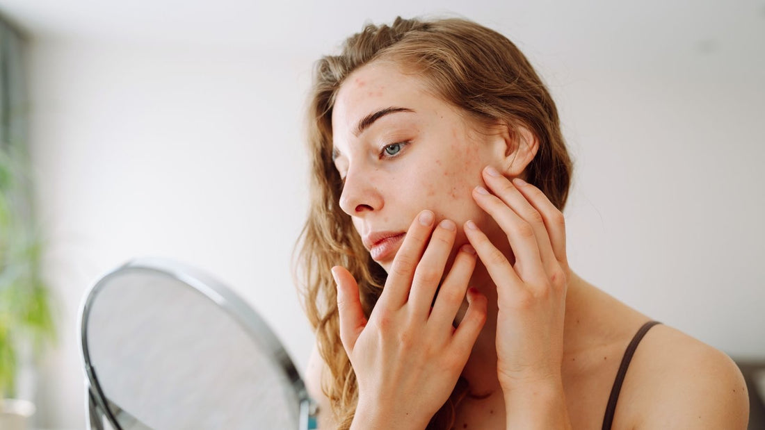 Hangi Aktif Madde Senin İçin? AHA, BHA, Retinol, C Vitamini ve Niasinamid Rehberi