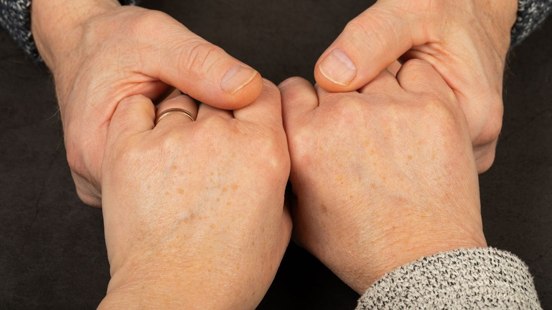 El Kırışıklığına Ne İyi Gelir? El Üstündeki Lekelere Karşı Çözümler