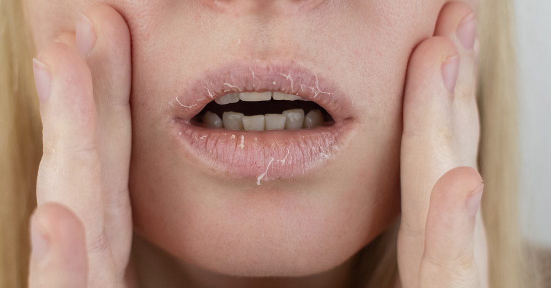 Lip Balm Nedir, Ne İşe Yarar? Doğru Kullanım Rehberi