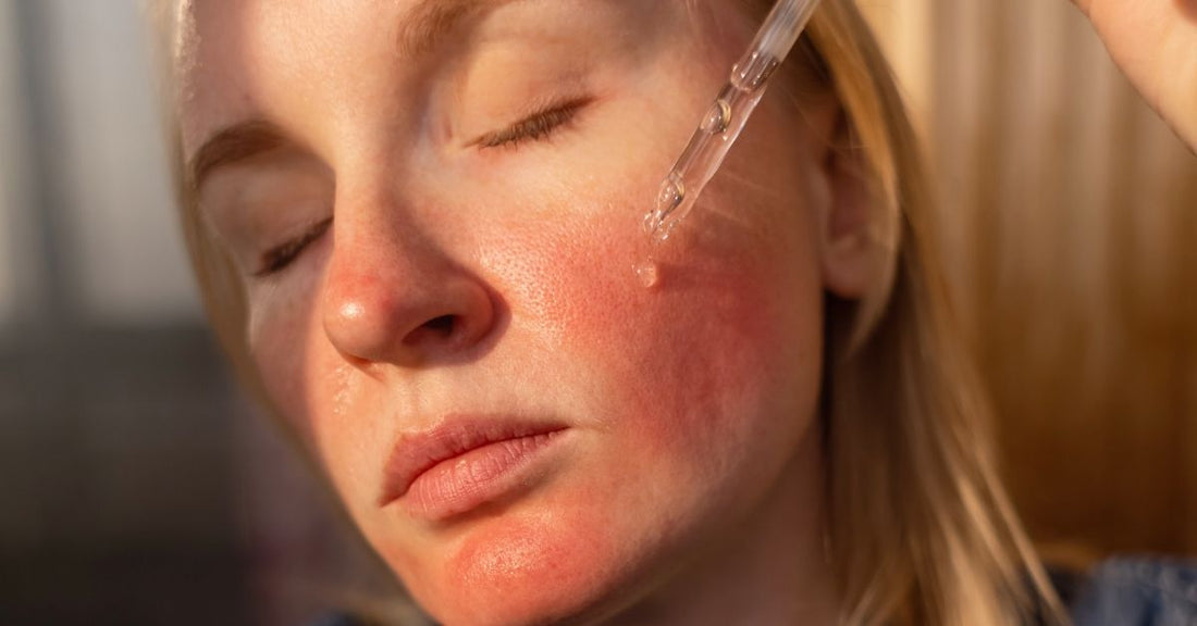 Niacinamide Nedir? Cildinizi Dönüştüren Bu Serumun Sırlarını Öğrenin