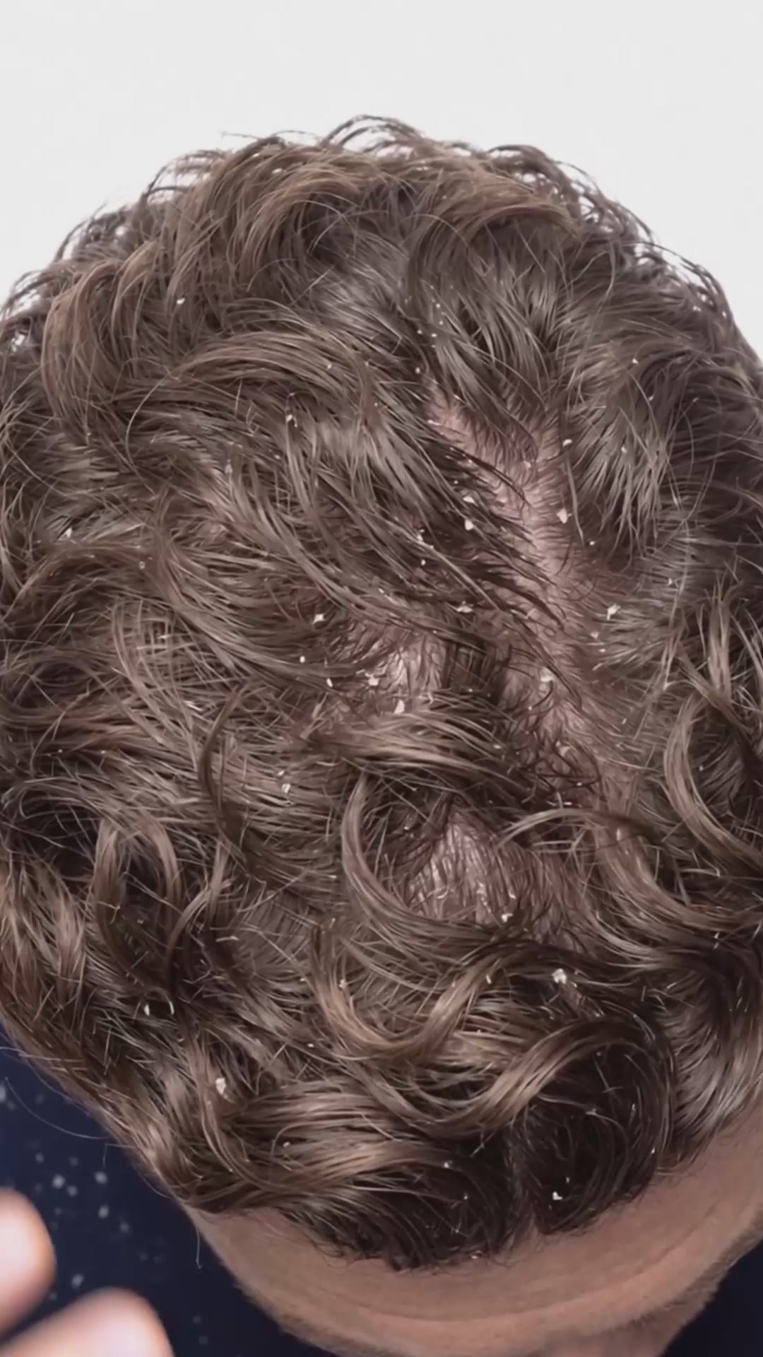 Load video: Purifying Anti-Dandruff Shampoo for Oily Hair